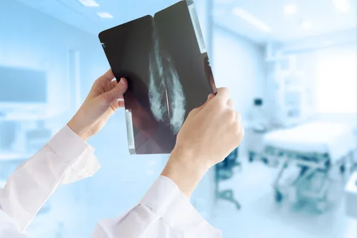 How U.S. Mammogram Guidelines Are Changing