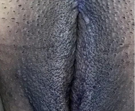 Intimate Lightening Before and After Vaginal Area