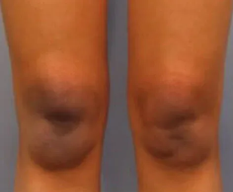 Intimate Lightening Before and After Legs