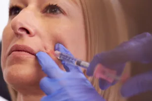 woman getting dermal fillers in Los Angeles