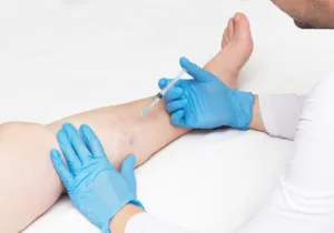 Doctor performs sclerotherapy for varicose veins on the legs in Los Angeles